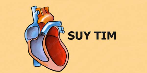 Tổng quan về bệnh suy tim: nguyên nhân, triệu chứng và cách hỗ trợ điều trị tại nhà hiệu quả